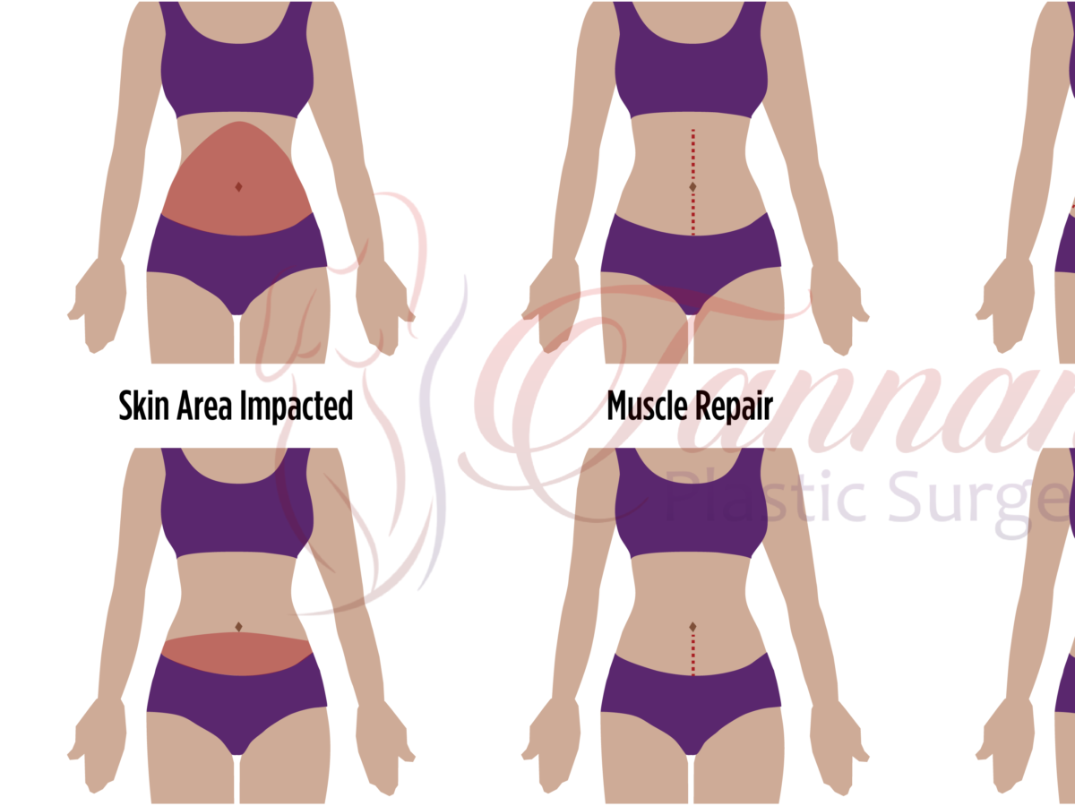 What is a Contour Pouch? The pouch is the center-front section of
