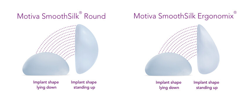 motiva breast implant options